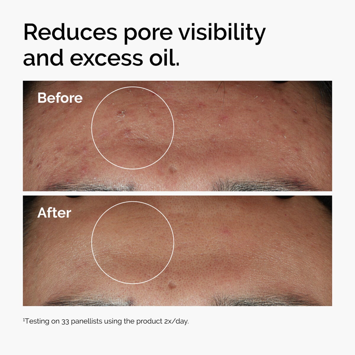 Zinc And Pores photo